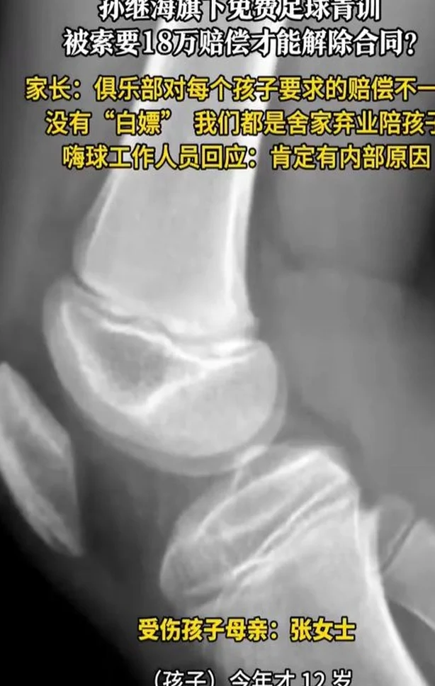 孙继海青训暴雷？小球员因伤退出，被索要18万，或另有隐情相关图二